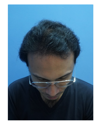 januar - one of our patient journey after 7 months